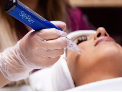 Microneedling / SkinPen